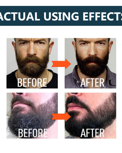 Beard Care Solution Gentle And Shine Men's Beard Strong Beard Root