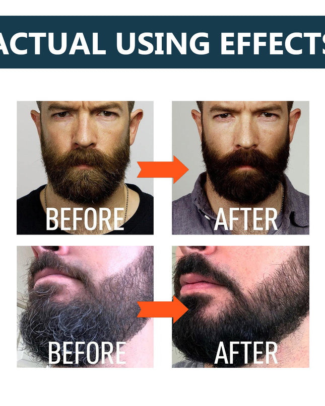 Beard Care Solution Gentle And Shine Men's Beard Strong Beard Root