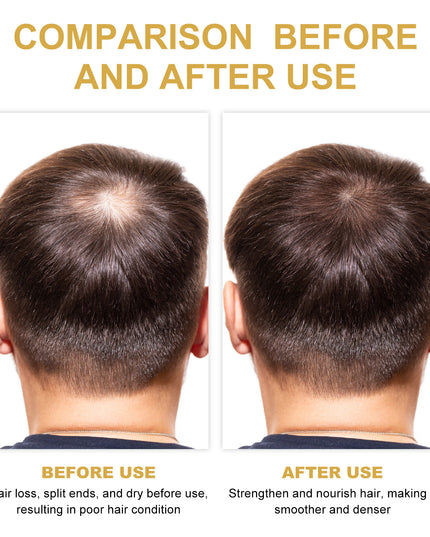 EELHOE Rosemary Hair Treatment Oil Scalp Cleansing Conditioning Volumizing Smoothing Repair Dry Frizzy Hair Conditioning Hair Treatment Oil