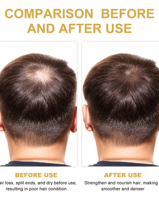 EELHOE Rosemary Hair Treatment Oil Scalp Cleansing Conditioning Volumizing Smoothing Repair Dry Frizzy Hair Conditioning Hair Treatment Oil