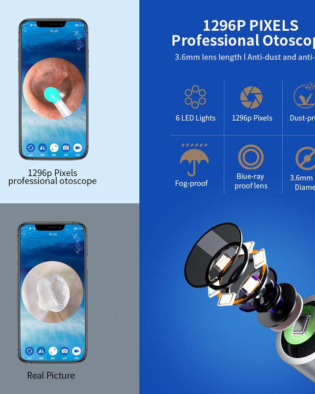 NE3 Wireless Ear Cleaner with Camera LED light - Here 4 you